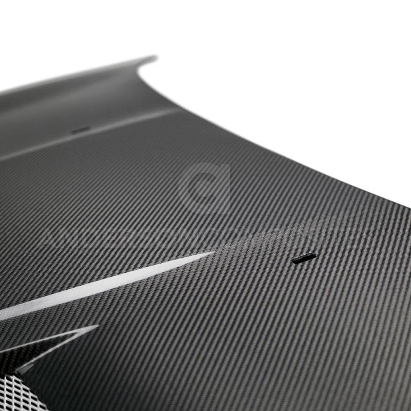 Anderson Composites 2015-2018 Ford Focus Carbon Fiber Type-TM Hood AC-HD16FDFO-TM